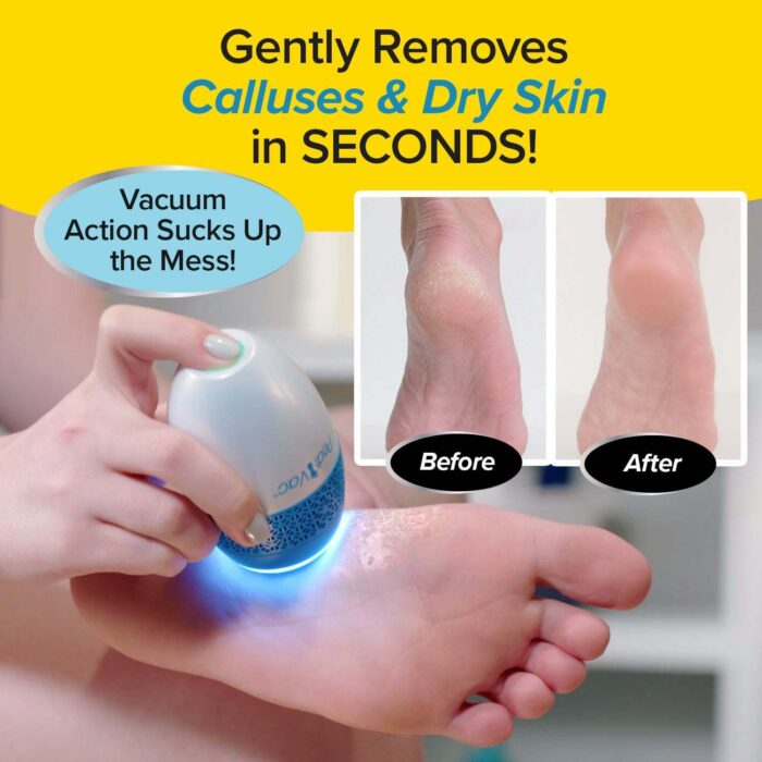 Pedi Vac Electric Callus Remover - Image 2